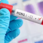 H1N1 Swine Flu Outbreak in India: Experts Warn of Rapid Spread – Are You at Risk